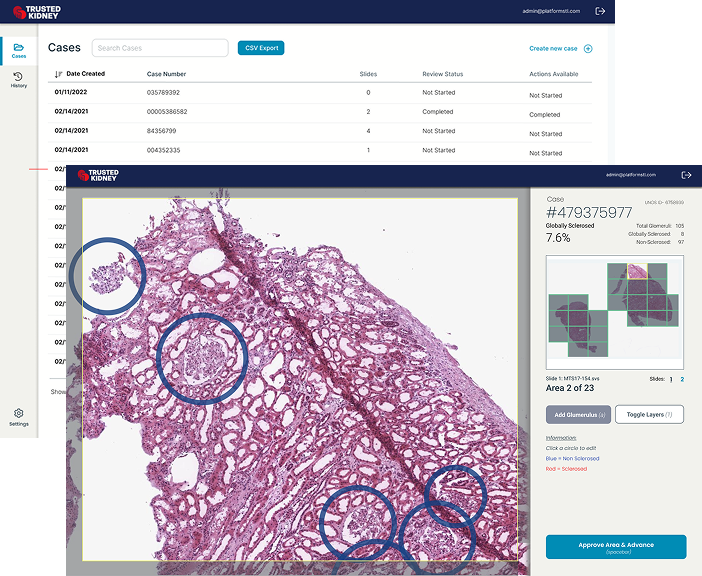 Trusted Kidney AI-powered transplant assessment platform: clinical interface with slide review tools and diagnostic error reduction